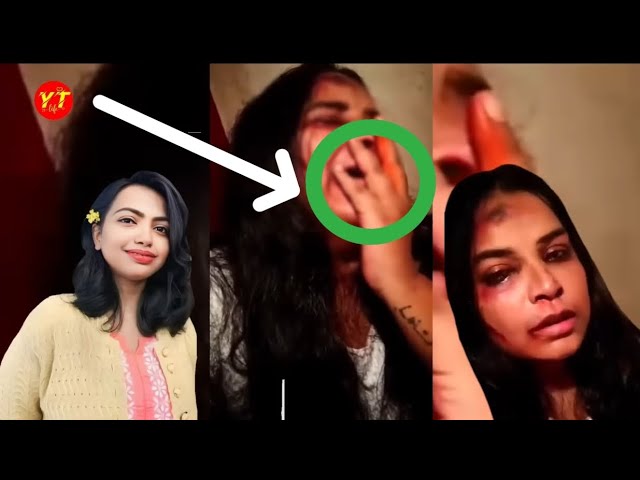 Moumita Video Viral , Watch Dr Moumita Debnath Full Viral Video Link